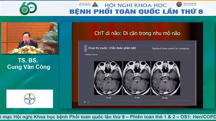 Bệnh ung thư phổi di căn não là gì