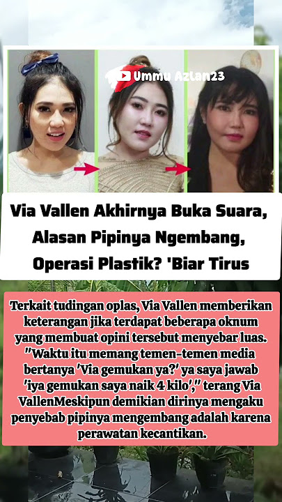Via Vallen Angakat Bicara Soal Ditud1n9 Gagal Oplas,