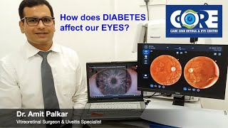 Diabetic Retinopathy | How does Diabetes affects Eyes Diabetic Retinopathy care_one_retina_eye