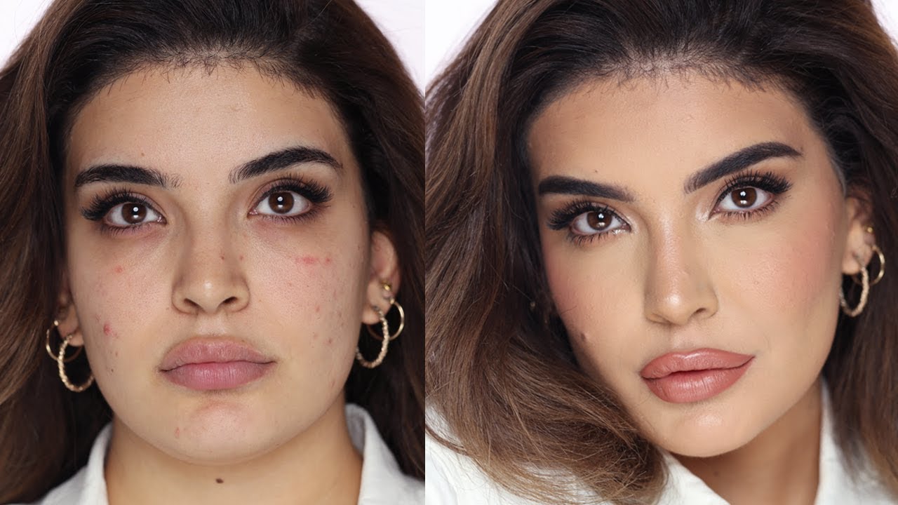 HOW TO COVER UP ACNE | Hindash