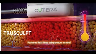 Fat Reduction - truSculpt by Cutera 2020 (Body Sculpting Medical Device 3D Animation)