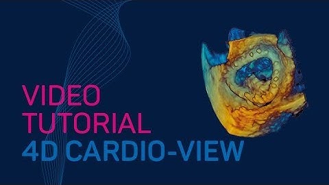 4D CARDIO-VIEW TAVR Video Tutorial #TTA2.30