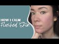 How I Calm Temperature Induced Flushed, Irritated, Itchy Skin |  @michxmash