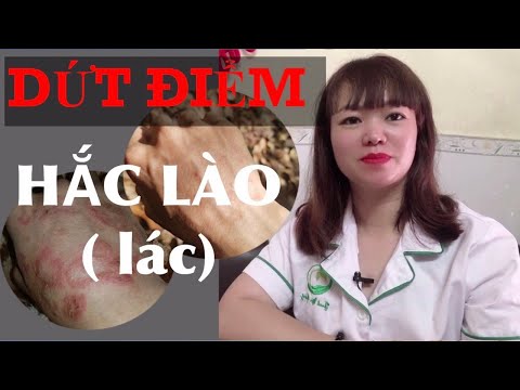 Video: Bệnh hắc lào trên củ cải: Tìm hiểu về bệnh hắc lào ở cây củ cải