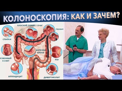 #Колоноскопия кишечника – как проходит процедура, зачем нужна?