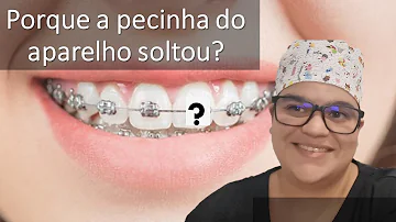 Como é o nome das peças do aparelho?