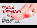 ✅ КИНЕЗИОТЕЙПИРОВАНИЕ ПРИ ПЯТОЧНОЙ ШПОРЕ | Сания Абдрахманова | Учебный центр BBALANCE