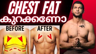 ആഴ്ച്ചകൾ കൊണ്ട് നെഞ്ചിലെ കൊഴുപ്പ് കത്തിക്കാം | How To Lose Chest Fat Fast | Gynecomastia | Malayalam