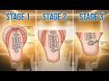 Development of urinary system 1 kidney