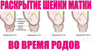 ШЕЙКА МАТКИ ВО ВРЕМЯ РОДОВ | На сколько пальцев открывается матка при родах в норме