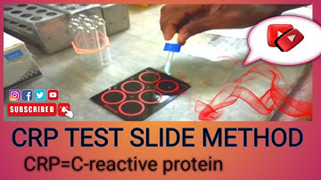 CRP TEST SLIDE METHOD|| Latex Agglutination Solution Test#crptest #crptestslidemethod#agglutination.