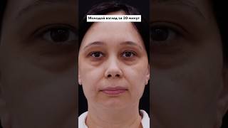 Молодой взгляд за 30 минут. Круговая блефаропластика. Пластический хирург ЕГОРОВА МАРИЯ