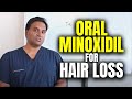 Oral Minoxidil