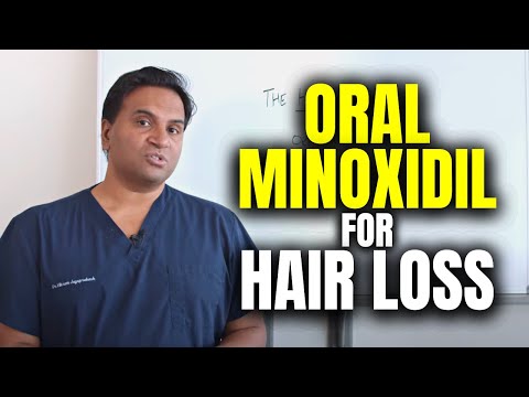 Oral Minoxidil