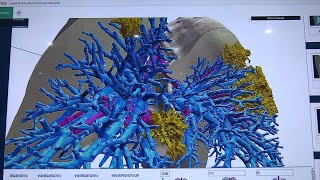 Coronavirus fight: AR, 5G and 3D modeling help doctors in teleconsultation