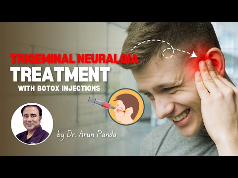 b12 injections for trigeminal neuralgia Trigeminal Neuralgia Treatment with Botox Injections by Dr. Arun Panda |  Bodyskulpt Aesthetics