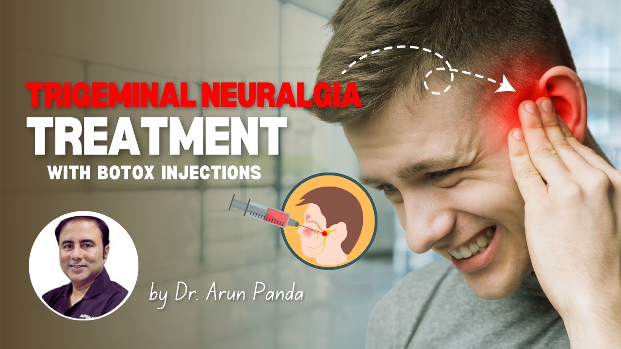 Trigeminal Neuralgia Treatment with Botox Injections by Dr. Arun Panda | Bodyskulpt Aesthetics