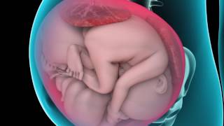 Learn about caesarean section