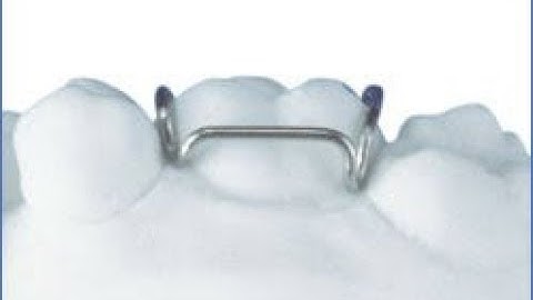 ADAMS CLASP | SUBSCRIBE FOR MORE