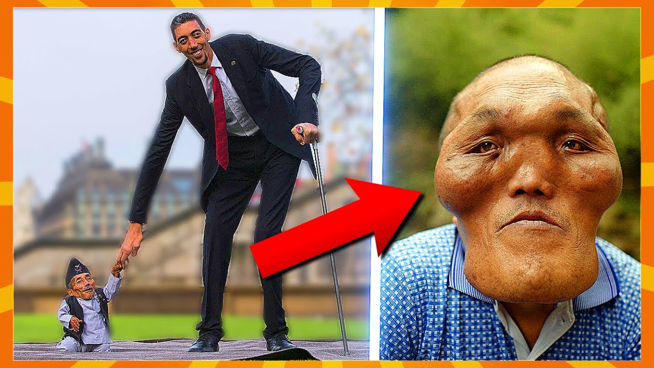 10 Meget Specielle Mennesker!