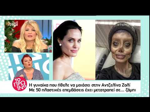 Βίντεο: Μοιάζει με ένα κορίτσι από τη δεκαετία του '90: Η Αλένα Βοδονέβα με λαμπερό μακιγιάζ ήταν λάθος για την Αντζελίνα Τζολί