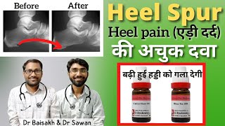 एड़ी दर्द का इलाज- Calcaneal spur/Heel spur ki homeopathic medicine / एड़ी दर्द की दवा screenshot 3