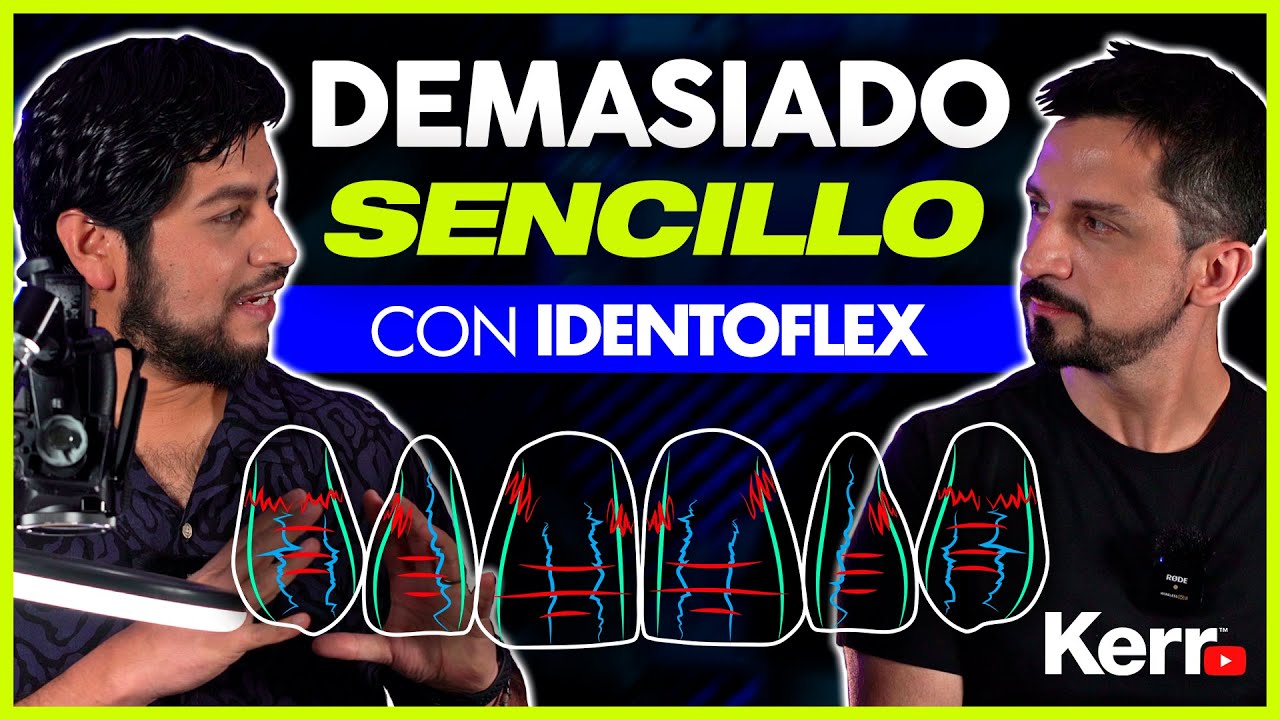 DEMASIADO SENCILLO con IDENTOFLEX 😎👌 - Acabado y Pulido con el Dr. Renzo Caselli 👊