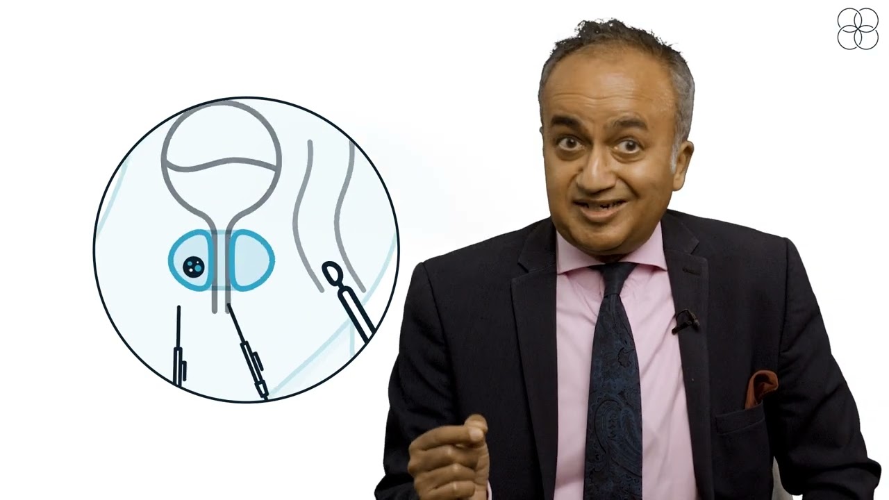 Mr Raj Nigam Is NanoKnife better than HIFU