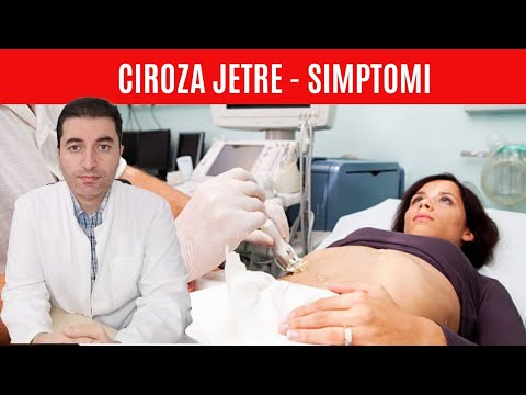 Video: Ciroza I Fibroza Jetre U Mačaka