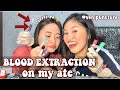 BLOOD EXTRACTION ON MY ATE (venipuncture) ✨ // medtech vlog