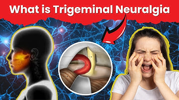 Understanding Trigeminal Neuralgia: Causes, Symptoms, and Treatment