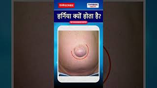 हरनय कय हत ह