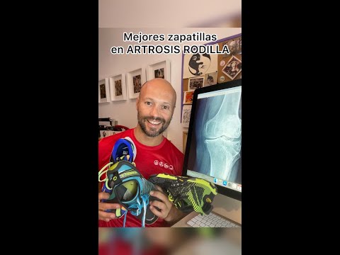 Video: Cómo elegir zapatos para la osteoartritis: 14 pasos (con imágenes)