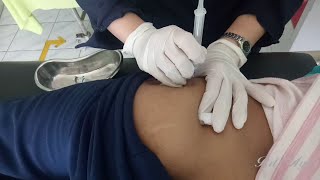 28# Slow motion video injection process || Injection in the prone position