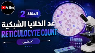 My practical workshop: Estimating the reticulocyte count 🩸