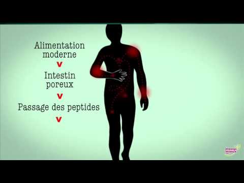 Vidéo: Ankylose De L'articulation - Traitement, Symptômes, Causes