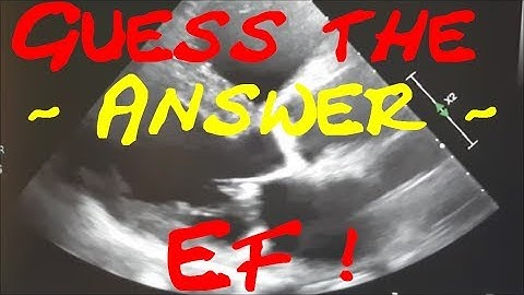 Guess the EF 2: Answer Video. Cardiology Forum. Echocardiography. Myocardial infarction,Myocarditis?