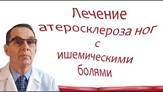 Лечение атеросклероза артерий ног с ишемической болью. Вмдеобеседа для ВСЕХ