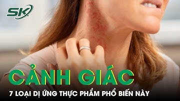 Cảnh Giác Với 7 Loại Dị Ứng Thực Phẩm Phổ Biến Này | SKĐS
