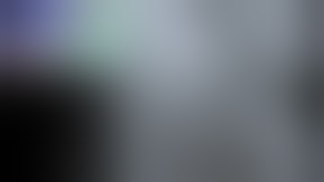 TCTAP 2014 Main Live Case Session VIII. France