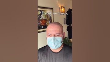 Scalp Micropigmentation in Edmonton Alberta Canada