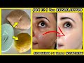 I Added POTATO - LEMON to Soap, See The SHOCKING Result ALIVE ! 3 Tone SKIN WHITENING POTATO Soap