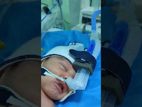 الطفل على جهاز السيباب