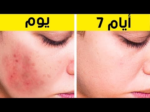 فيديو: 3 طرق لتغطية البقع الداكنة على وجهك