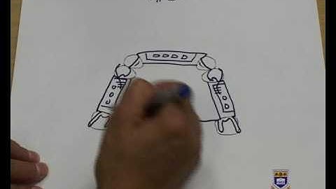 Designing an Upper Metal Partial Denture Class III