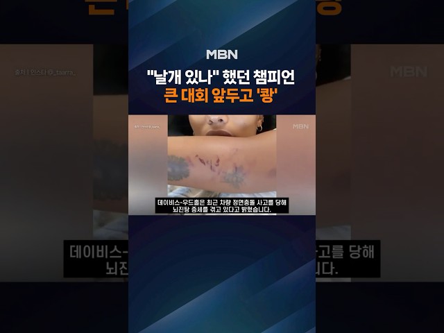 "날개 있나" 싶었던 멀리뛰기 챔피언, 차량 정면충돌…"뇌진탕 증세"