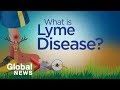 Why Lyme disease is on the rise, explained