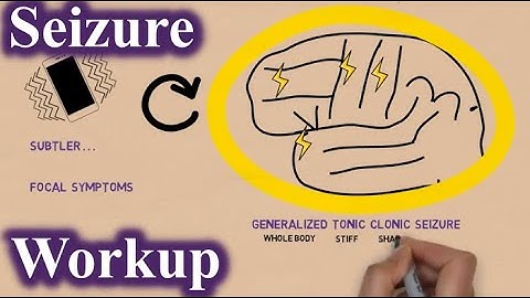 NEURO: Seizure Investigation made easy