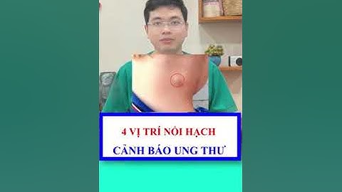 4 vị trí nổi hạch cảnh báo U.NG T.H.Ư | Bác sĩ Hội
