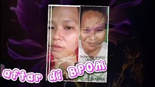 Testimoni rutin skincare Leafhea
